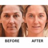 Retinol Wrinkle Miracle, , large